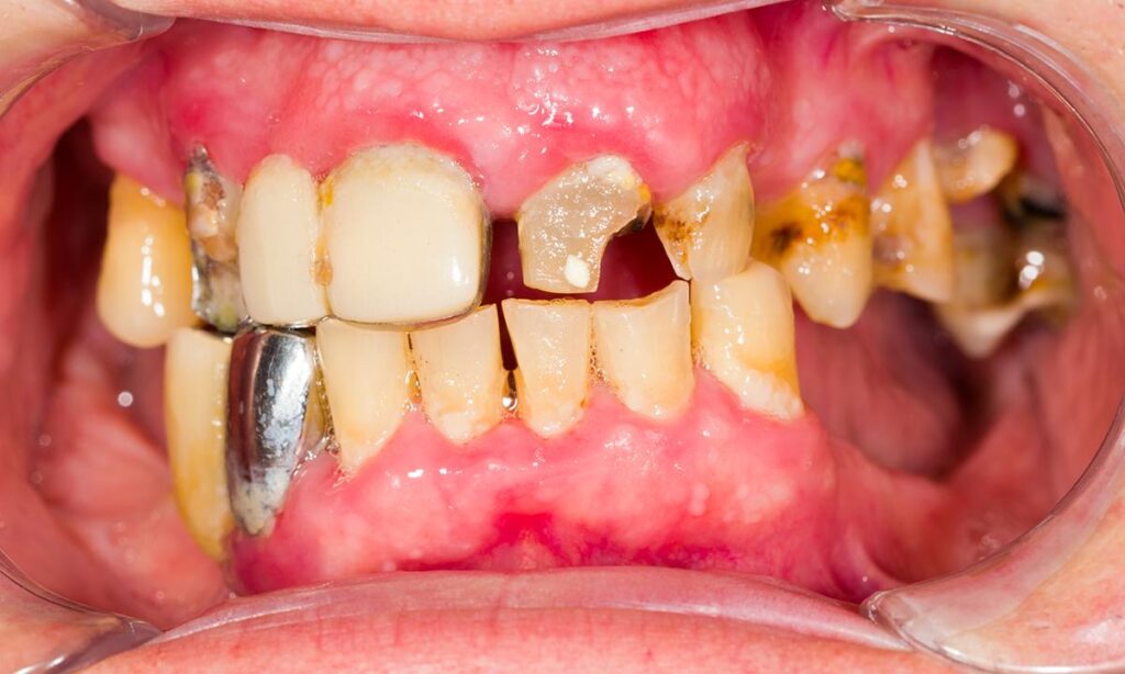 Why Poor Oral Hygiene Puts Your Health at Risk: A Friendly Guide