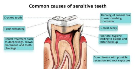 Say Goodbye to Tooth Sensitivity: Tips for Relief and Prevention