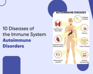 Recognizing Autoimmune Disorders in Women: Hope and Support