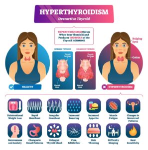 Embracing Thyroid Health: A Woman’s Journey to Well-Being