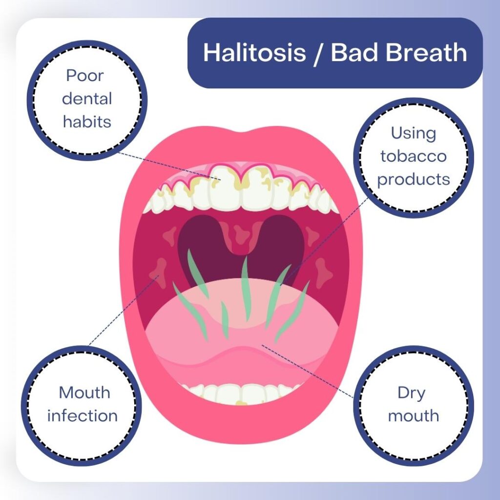 Say Goodbye to Bad Breath: Natural Remedies That Work!