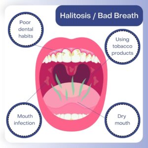 Say Goodbye to Bad Breath: Natural Remedies That Work!