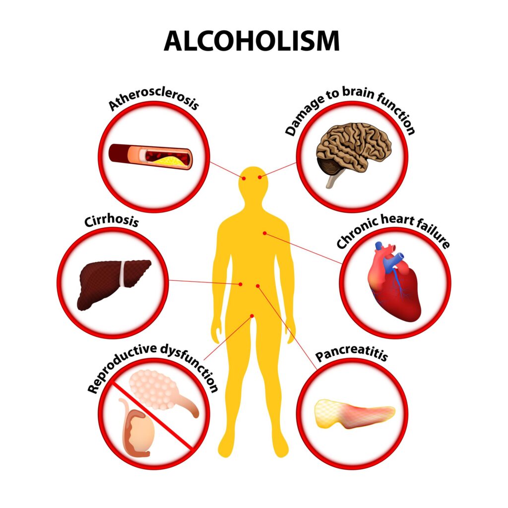 Understanding Alcohol’s Effect on Nutritional Balance