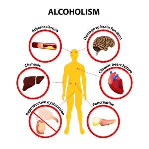 Understanding Alcohol’s Effect on Nutritional Balance
