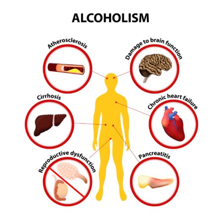Understanding Alcohol’s Effect on Nutritional Balance