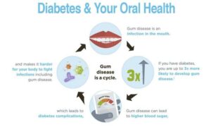 Sweet Smiles: How Diabetes Affects Your Oral Health