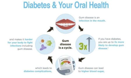 Sweet Smiles: How Diabetes Affects Your Oral Health