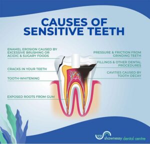 Say Goodbye to Tooth Sensitivity: Tips for a Brighter Smile!
