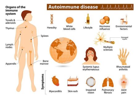 Recognizing Autoimmune Disorders in Women: Signs and Support