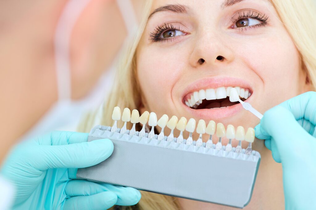 Unlocking the Bright Smile: Your Guide to Teeth Whitening