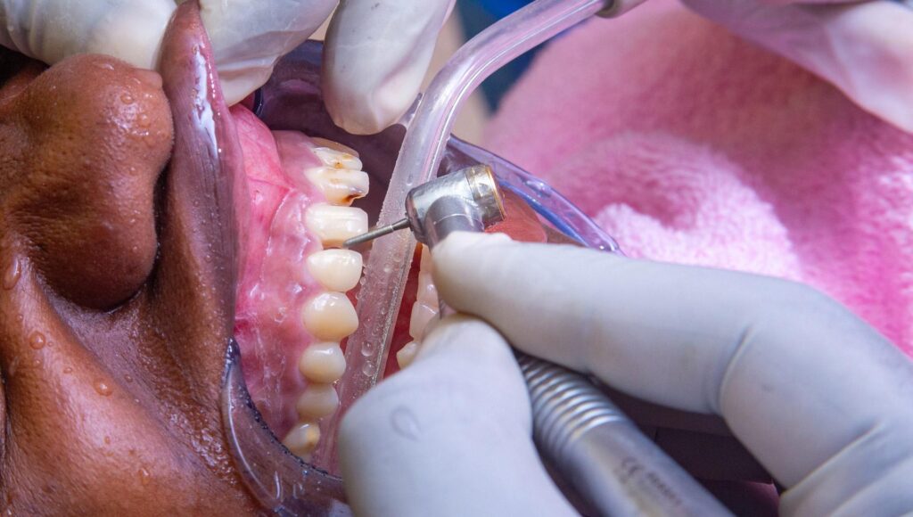 Unlocking Smiles: The Hidden Dangers of Poor Oral Hygiene
