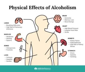 The Hidden Effects of Alcohol on Your Nutritional Balance