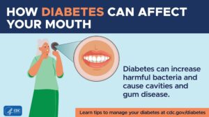 Sweet Connections: How Diabetes Impacts Your Oral Health