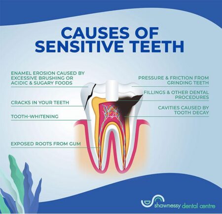 Say Goodbye to Tooth Sensitivity: A Friendly Guide